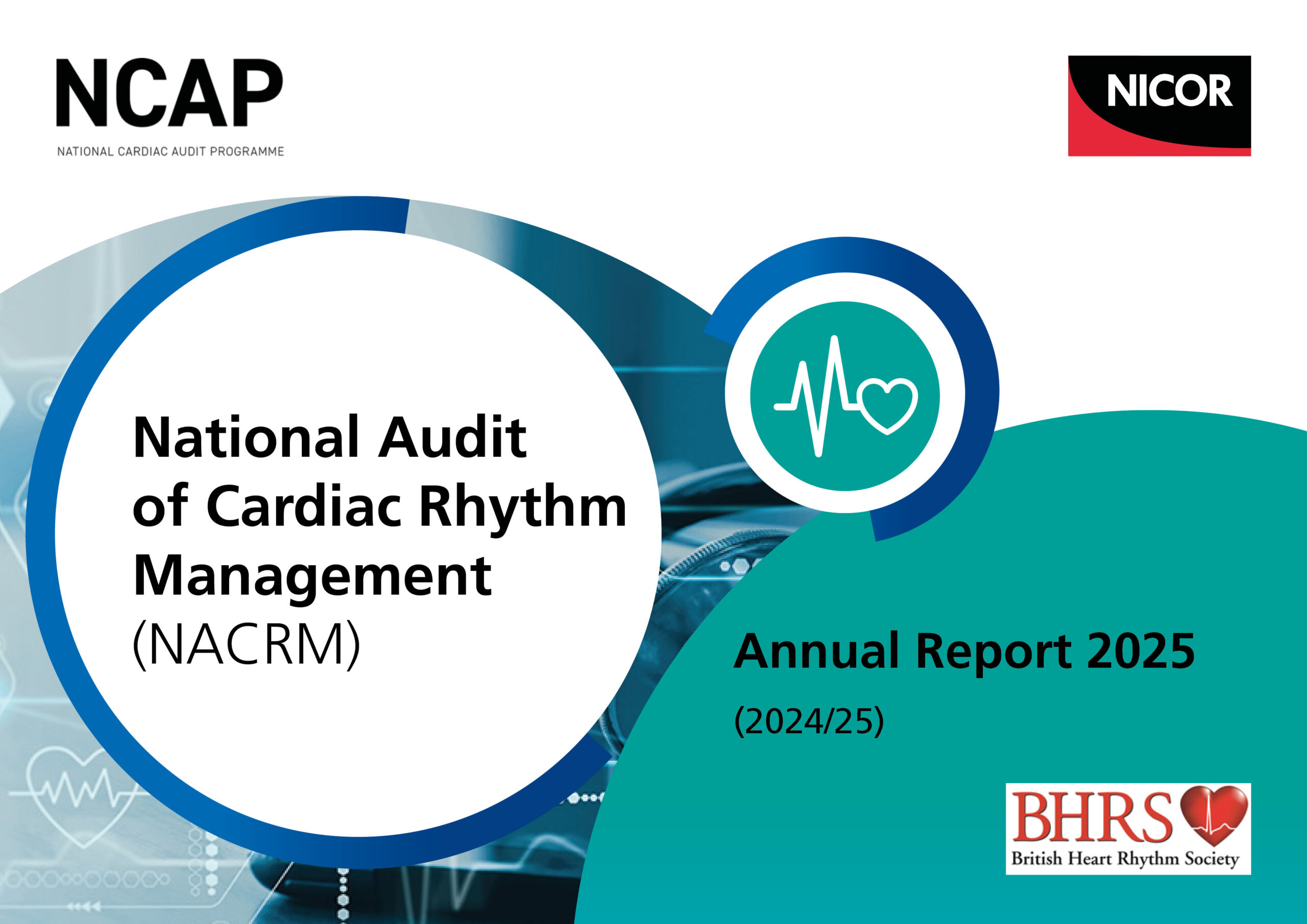National Audit of Cardiac Ryythm Management (NACRM) Annual Report 2025 (2024/25)