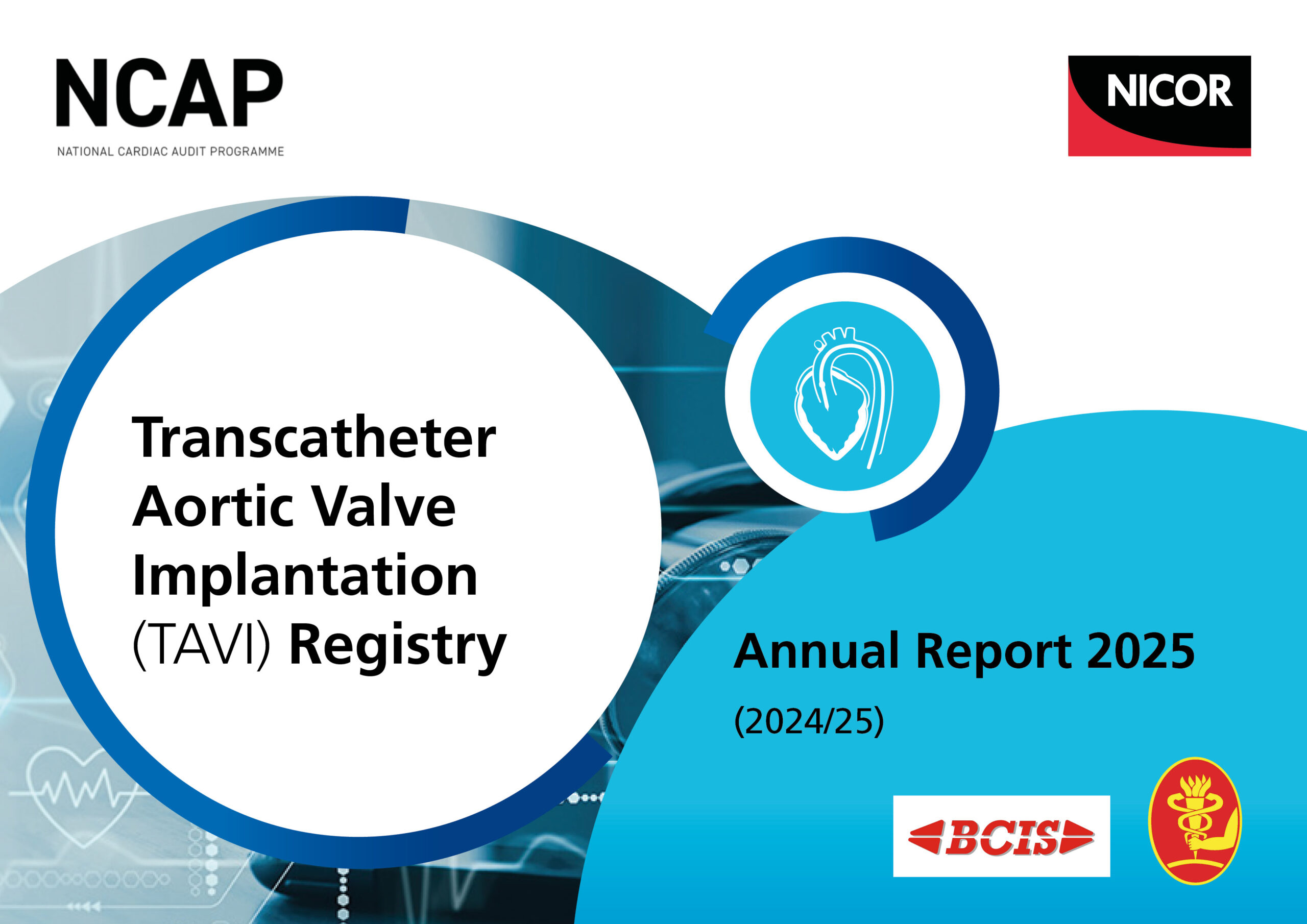 Transcatheter Aortic Valve Implantation (TAVI) Registry Annual Report 2025 (2024/25)
